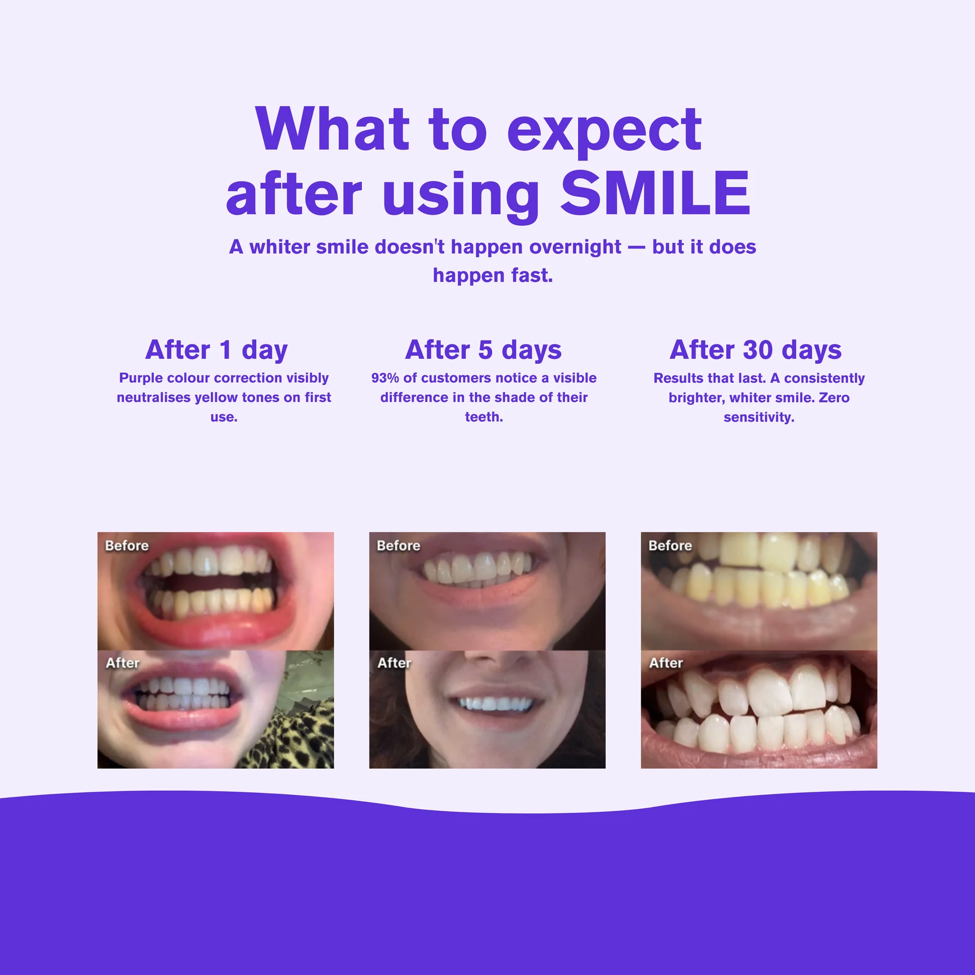 Purple whitening Strips